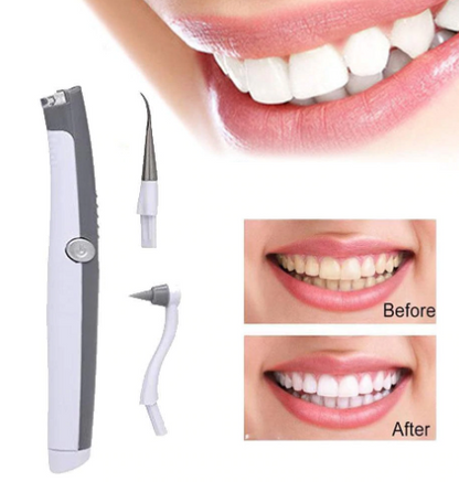 Teeth Cleaning Polisher Set - Electric Dental Tools